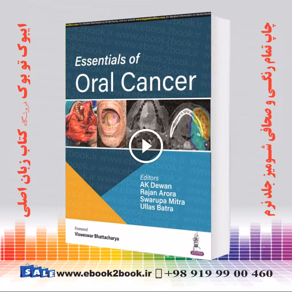 Essentials of Oral Cancer