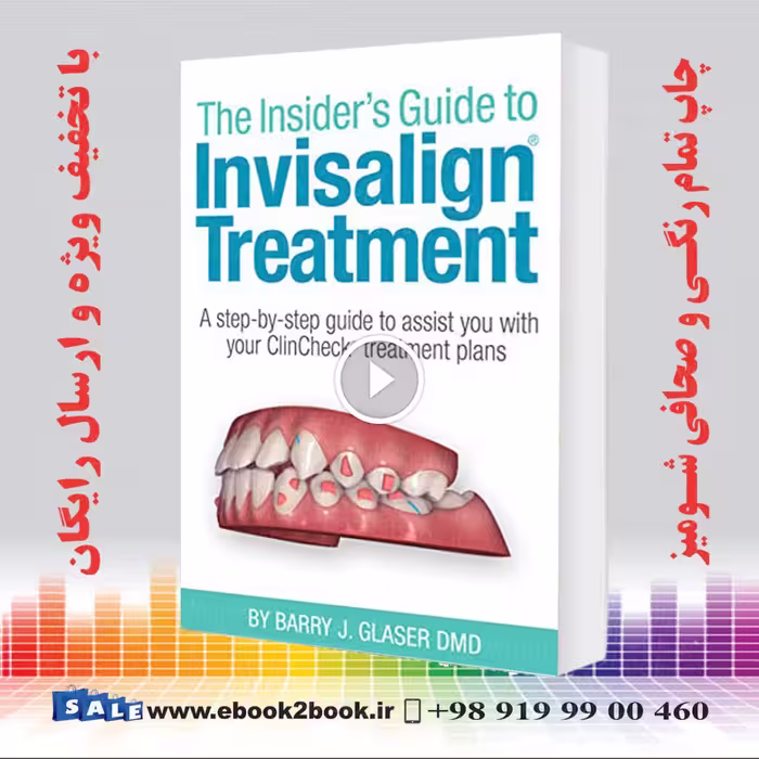Insider’s Guide to Invisalign Treatment