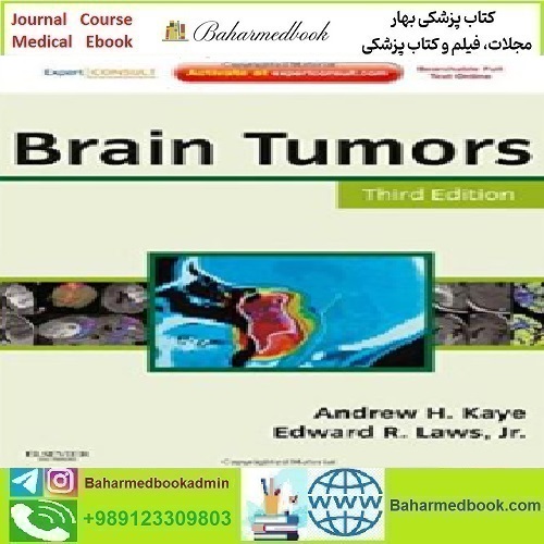 Brain Tumors An Encyclopedic Approach 2012 TRUE PDF price 1€ - کتاب پزشکی بهار