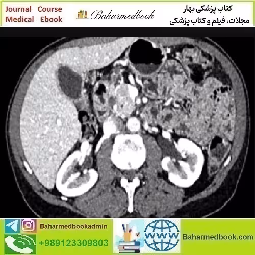ARRS Gastrointestinal Imaging Online Course 2019 video course