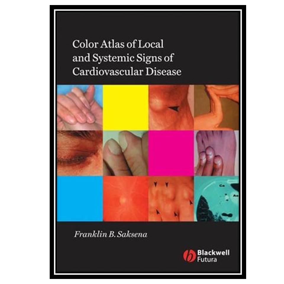 کتاب Color Atlas of Local and Systemic Manifestations of Cardiovascular Disease اثر Franklin B Saksena انتشارات مؤلفین طلایی