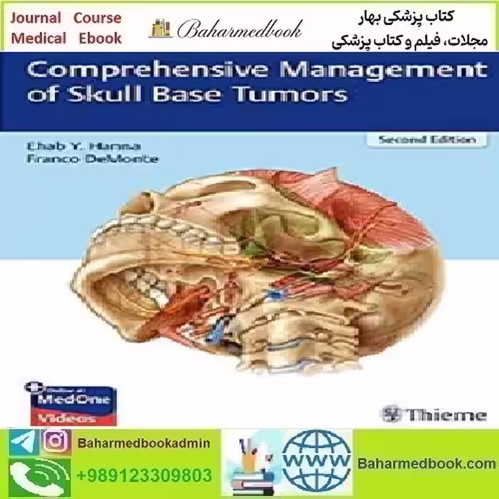 Comprehensive Management of Skull Base Tumors 202