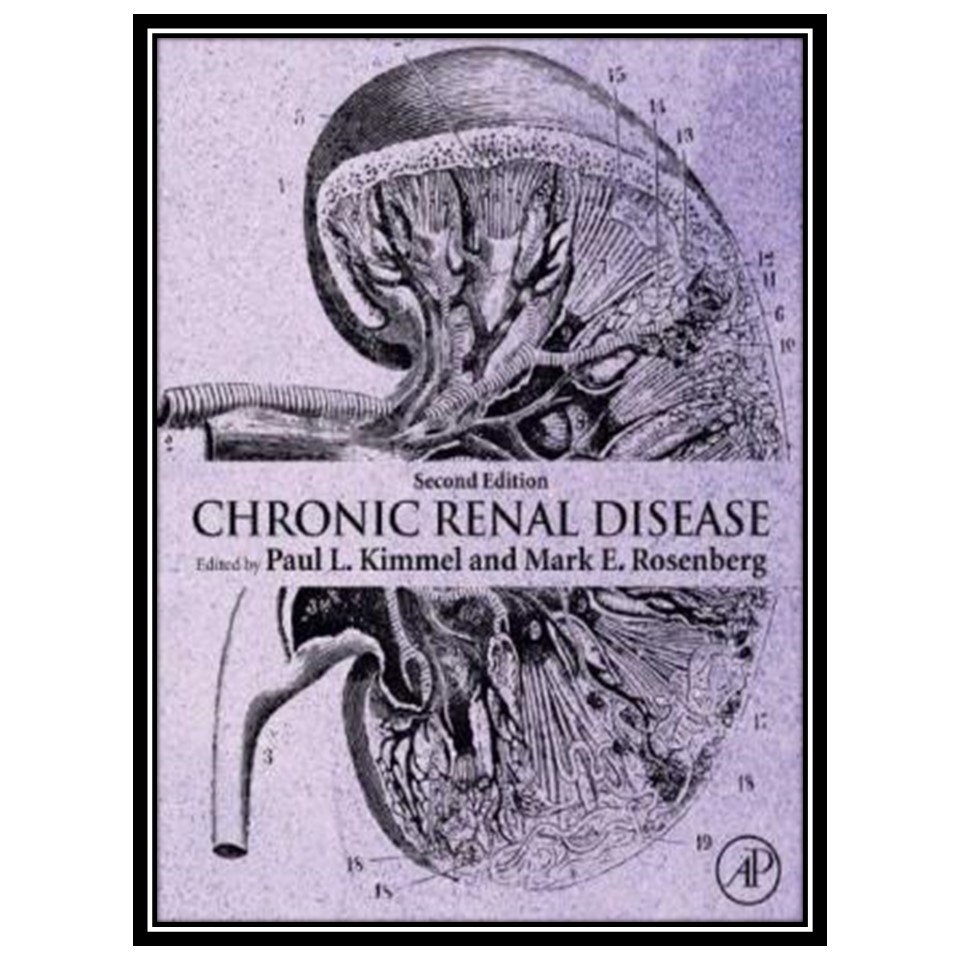 کتاب Chronic Renal Diseaser اثر Paul Kimmel and Mark Rosenberg انتشارات مؤلفین طلایی