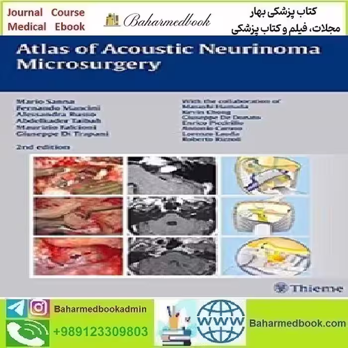 Atlas of Acoustic Neurinoma Microsurgery 2011 TRUE PDF pri