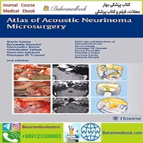 Atlas of Acoustic Neurinoma Microsurgery 2011 TRUE PDF pri