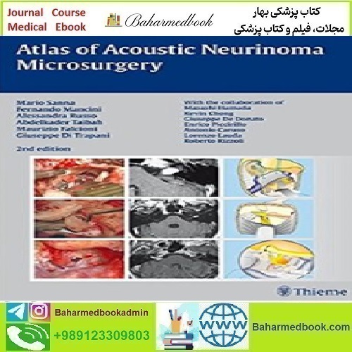 Atlas of Acoustic Neurinoma Microsurgery 2011 TRUE PDF pri