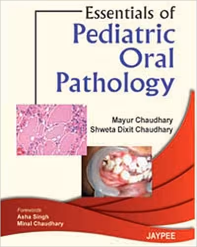 󾕇 دانلود کتاب Essentials Of Pediatric Oral Pathology, 2011 - دانلود کتاب های دانشگاهی