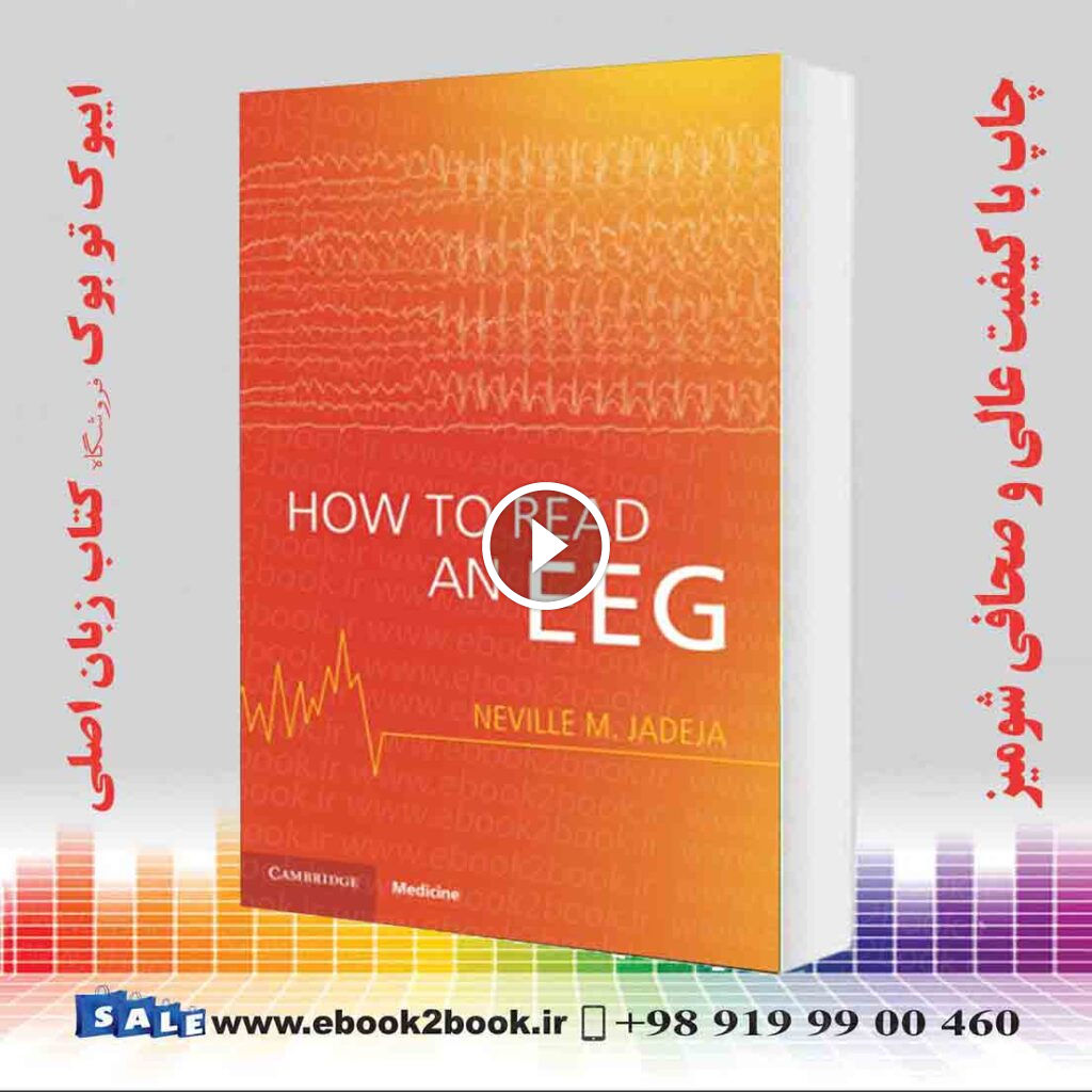 How to Read an EEG