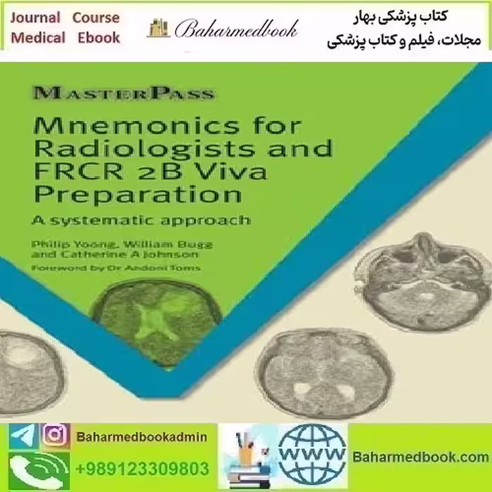 Mnemonics for Radiologists and FRCR 2B Viva Preparation A