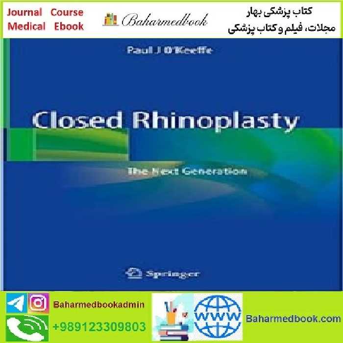 Closed Rhinoplasty TRUE PDF price 1€