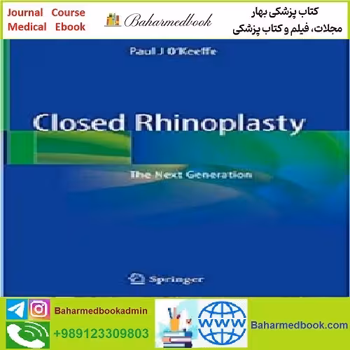 Closed Rhinoplasty TRUE PDF price 1€