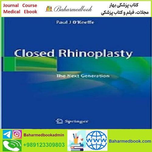 Closed Rhinoplasty TRUE PDF price 1€