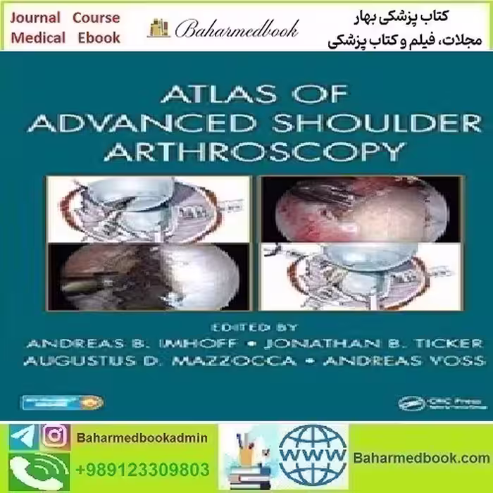 Atlas of Advanced Shoulder Arthroscopy 2018 TRUE PDF price 1€ - کتاب پزشکی بهار