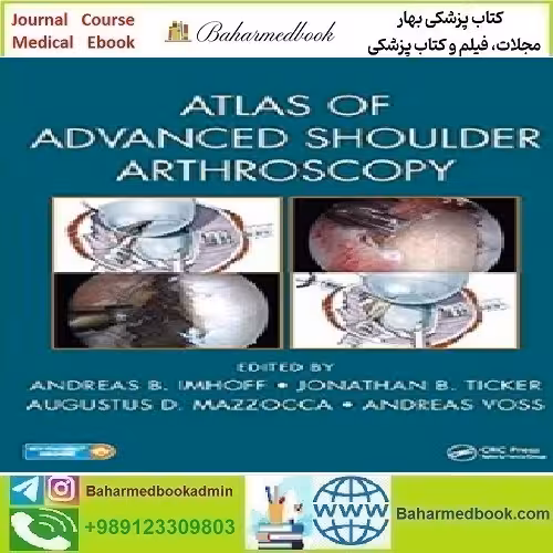 Atlas of Advanced Shoulder Arthroscopy 2018 TRUE PDF price 1€ - کتاب پزشکی بهار