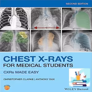Chest X-Rays for Medical Students 2ed 2020 TRUE PDF Price 1€