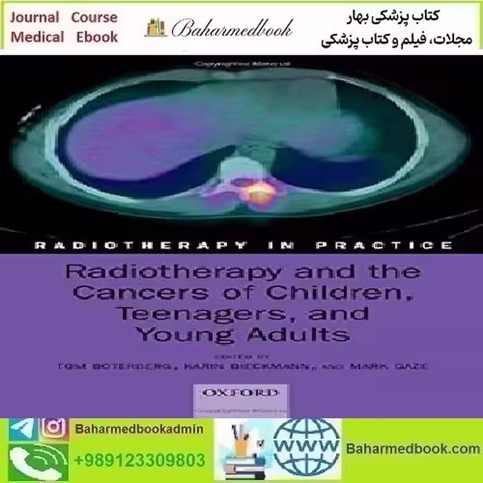 Radiotherapy and the Cancers of Children Teenagers and Young