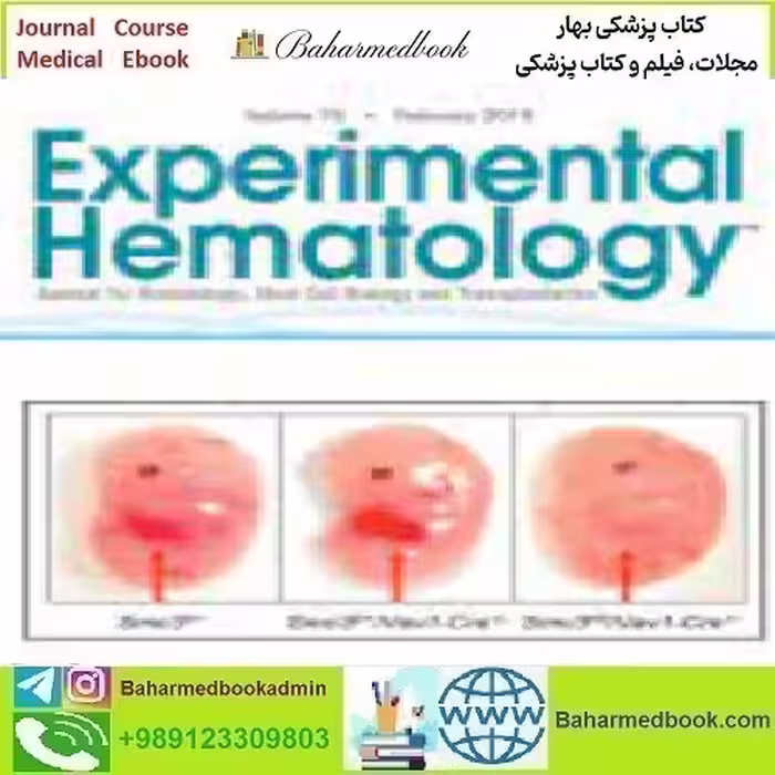 Experimental Hematology Volume 70 2019 TRUE PDF price 4€ - کتاب پزشکی بهار