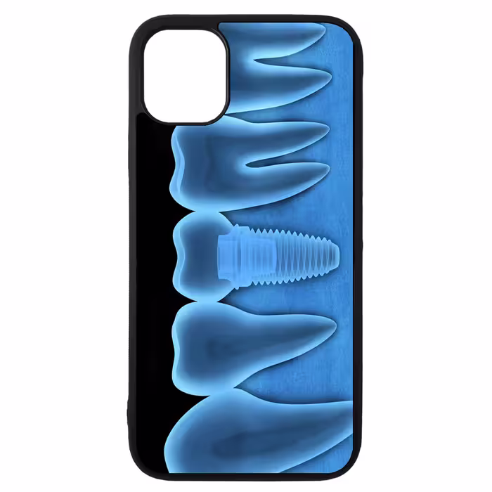 کاور طرح ایمپلنت کد 1146 مناسب برای گوشی موبایل اپل iphone 12