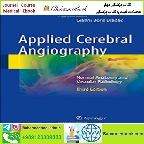 Applied Cerebral Angiography Normal Anatomy and Vascular Pat