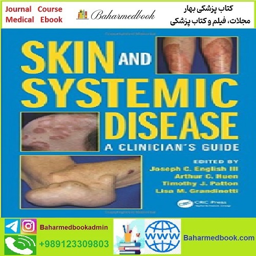 Skin and Systemic Disease A Clinician's Guide TRUE PDF price 1€ - کتاب پزشکی بهار