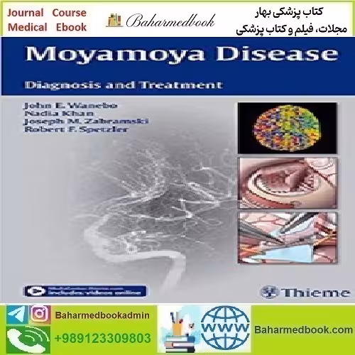 Moyamoya Disease Diagnosis and Treatment 2014 TRUE P