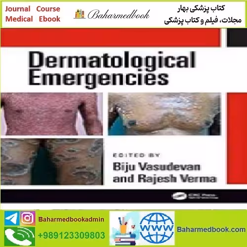 Dermatological Emergencies TRUE PDF price 1€ - کتاب پزشکی بهار