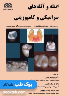 اینله و آنله های سرامیکی و کامپوزیتی