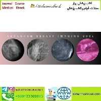 Advanced Breast Imaging 2024 CMEScience video
