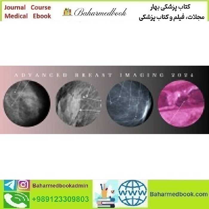 Advanced Breast Imaging 2024 CMEScience video