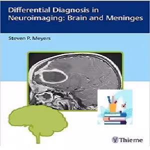 Differential Diagnosis in Neuroimaging Brain and Meninges TRU