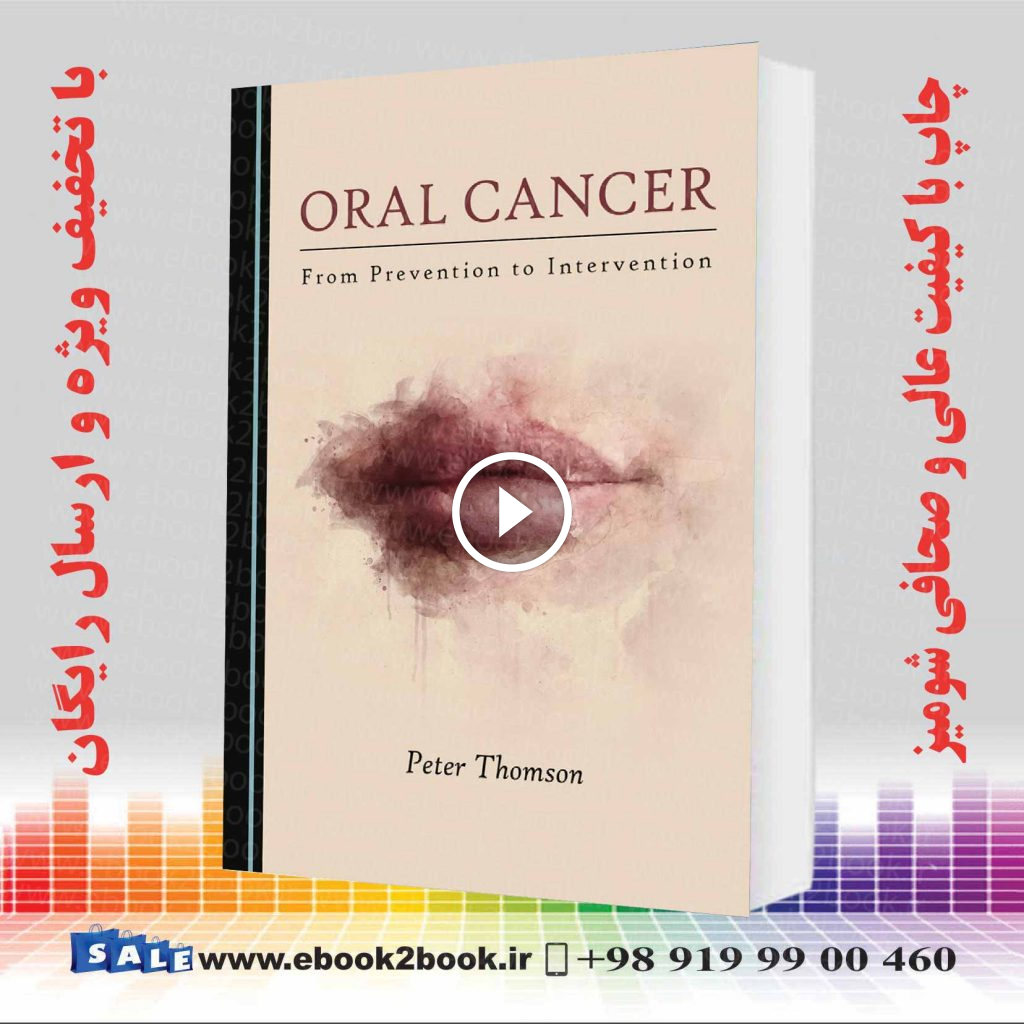 Oral Cancer