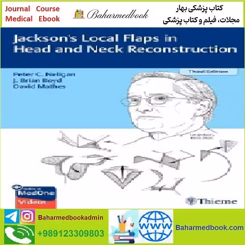 Jackson's Local Flaps in Head and Neck Reconstruction TR