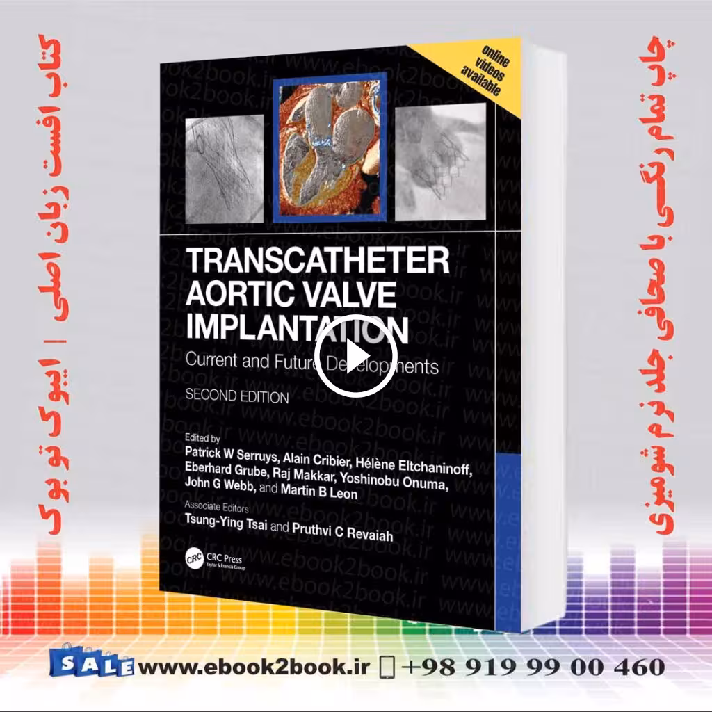 Transcatheter Aortic Valve Implantation