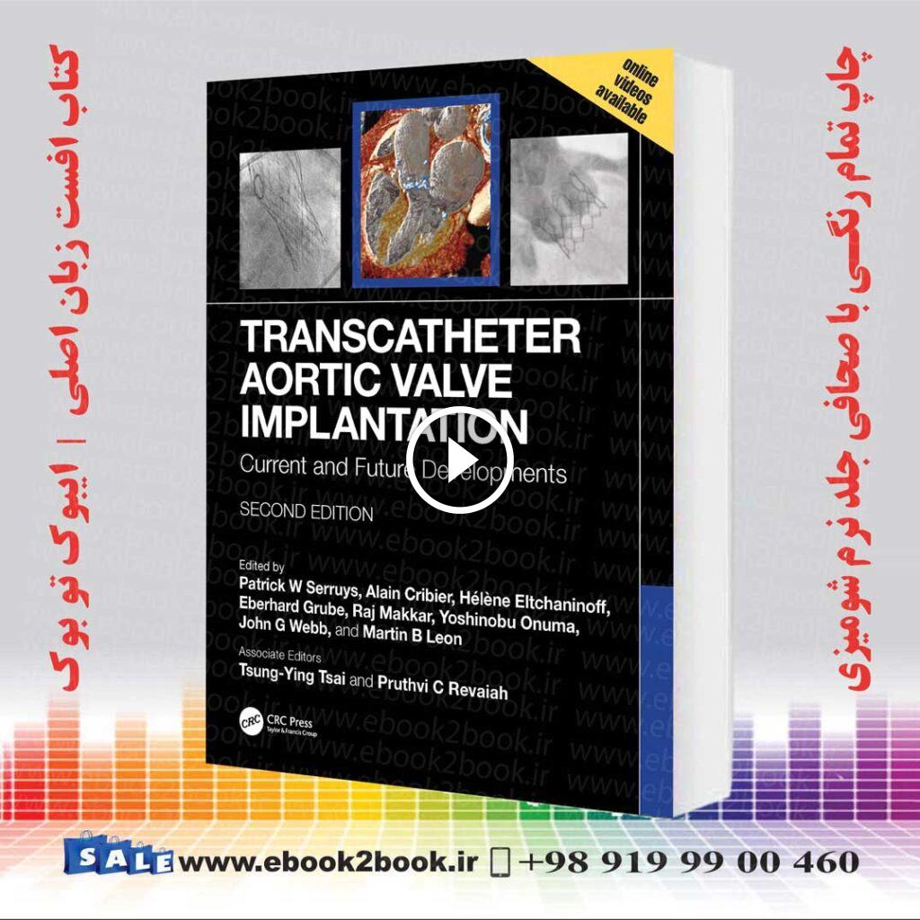 Transcatheter Aortic Valve Implantation
