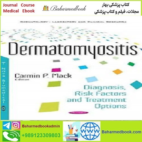 Dermatomyositis Diagnosis Risk Factors and Treatment Options