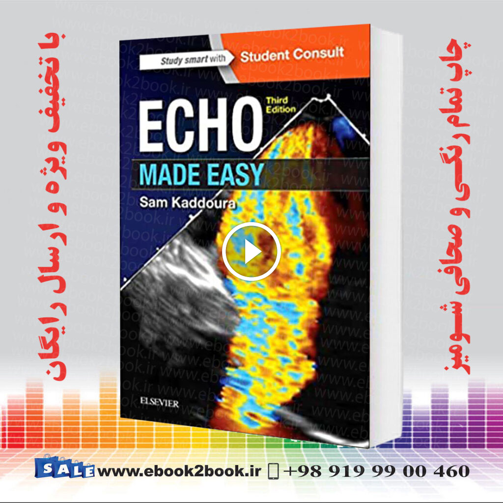 Echo Made Easy 3rd Edition