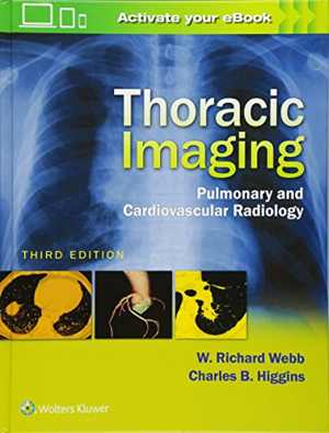 [PDF] دانلود کتاب Thoracic Imaging - Pulmonary And Cardiovascular Radiology, 3rd ed, 2016