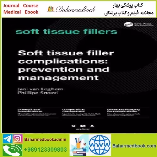 Soft Tissue Filler Complications Prevention and Management T