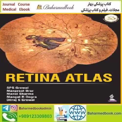 Retina Atlas 2021 TRUE PDF price 1€ - کتاب پزشکی بهار
