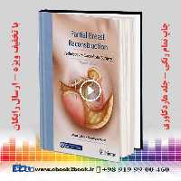 Partial Breast Reconstruction 2nd Edition