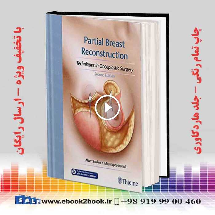 Partial Breast Reconstruction 2nd Edition