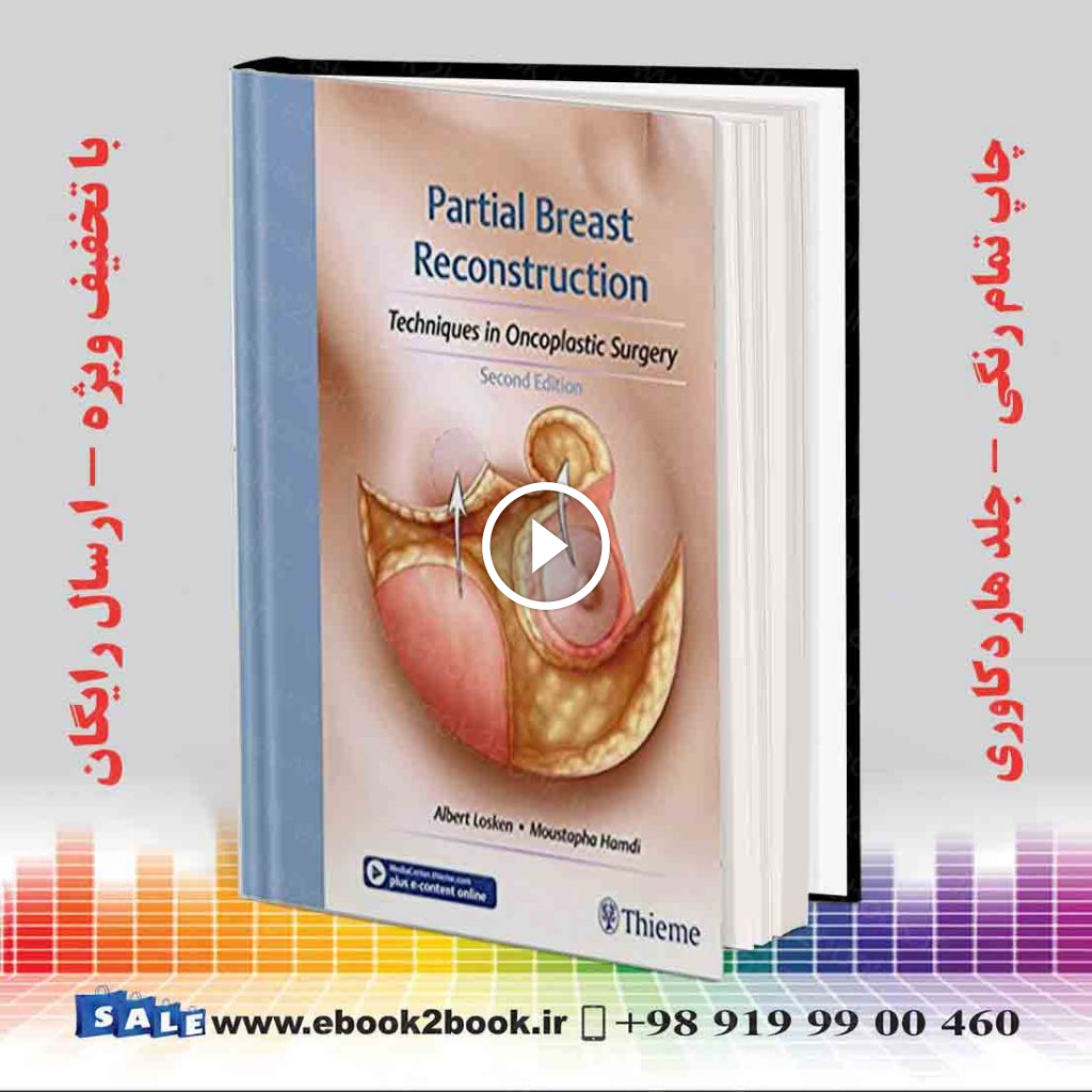 Partial Breast Reconstruction 2nd Edition