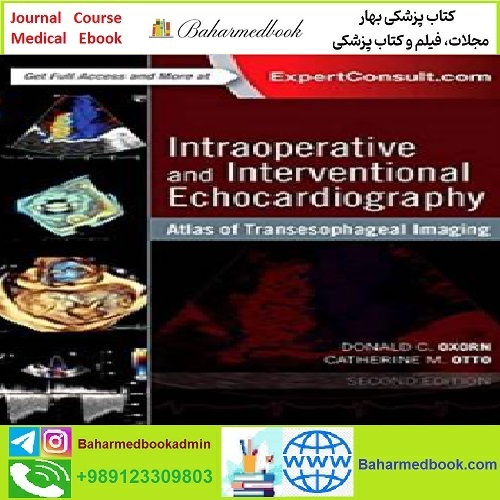 Intraoperative and Interventional Echocardiography TRUE PDF p
