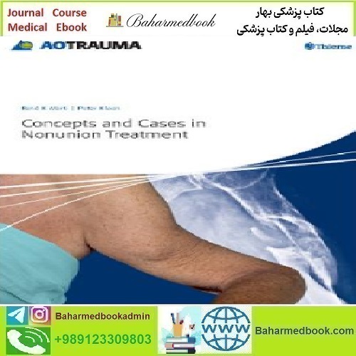 AO Concepts and Cases in Nonunion Treatment 2011 TRUE P