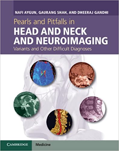  دانلود کتاب Pearls And Pitfalls In Head And Neck And Neuroimaging - Variants And Other Difficult Diagnoses, 2013 - دانلود کتاب های دانشگاهی