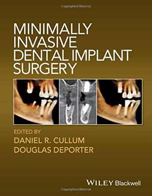 [PDF] دانلود کتاب Minimally Invasive Dental Implant Surgery, 2016