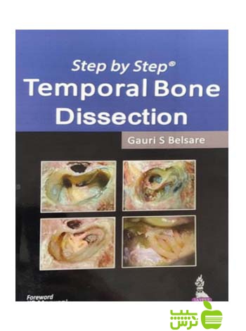 Step By Step Temporal Bone Dissection 2014 اندیشه رفیع - سیب ترش - SibTorsh