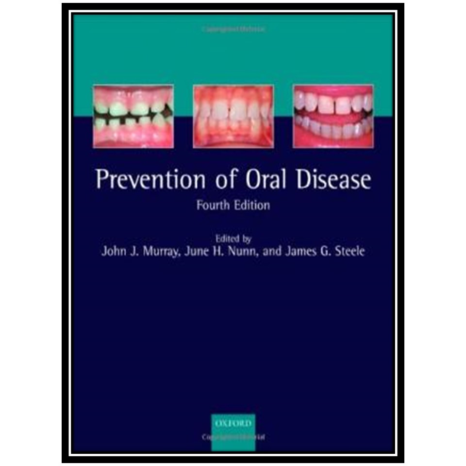 کتاب The Prevention of Oral Disease اثر جمعی از نویسندگان انتشارات مؤلفین طلایی
