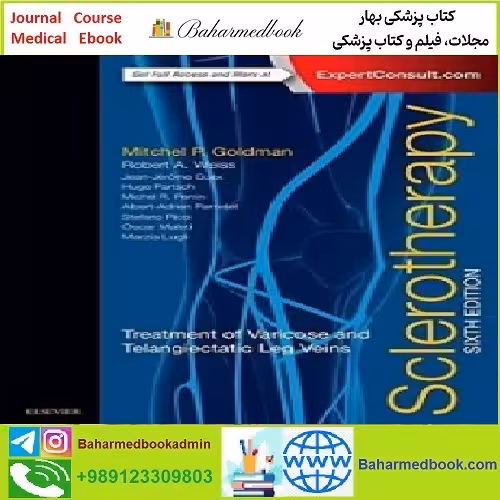 Sclerotherapy Treatment of Varicose and Telangiectatic Leg Veins