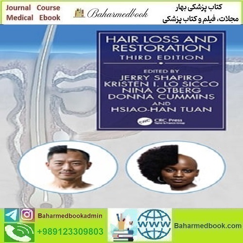 Hair Loss and Restoration 2024 TRUE PDF دانلود کتاب الکترونیکی
